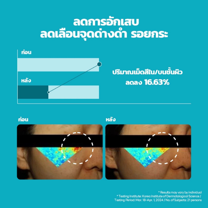 เซรั่มผิวเรียบเนียน MEDIHEAL Madecassoside Blemish Repair Serum