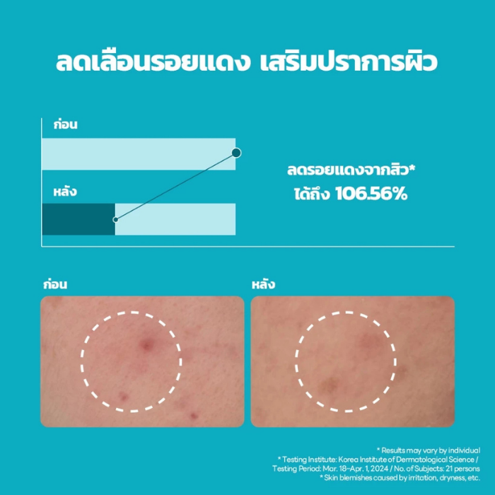 เซรั่มผิวเรียบเนียน MEDIHEAL Madecassoside Blemish Repair Serum