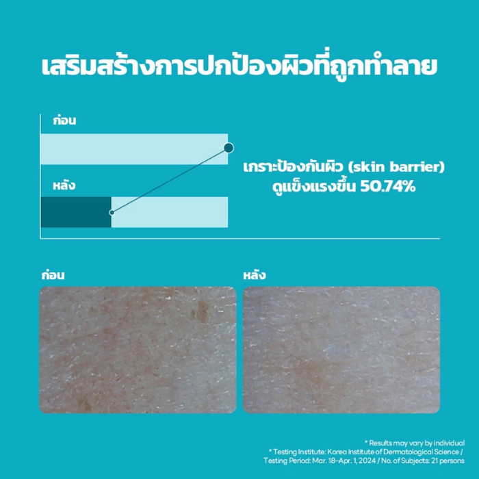 เซรั่มผิวเรียบเนียน MEDIHEAL Madecassoside Blemish Repair Serum