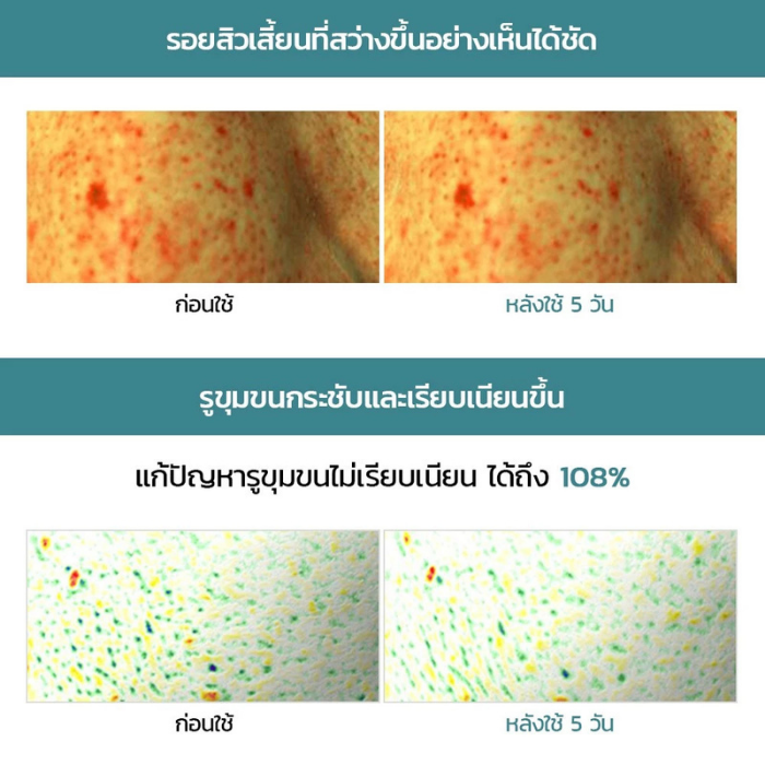 เซรั่มกระชับรูขุมขน MEDIHEAL Madecassoside Pore Repair Serum เซรั่มกระชับรูขุมขน MEDIHEAL Madecassoside Pore Repair Serum
