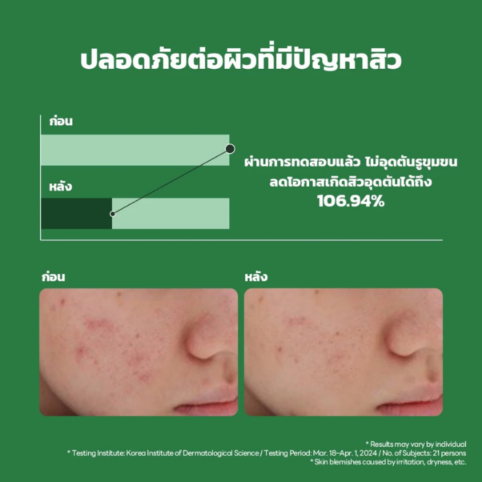 เซรั่มปลอบประโลมผิว MEDIHEAL Tea tree Calming Moisture Serum เซรั่มปลอบประโลมผิว MEDIHEAL Tea tree Calming Moisture Serum