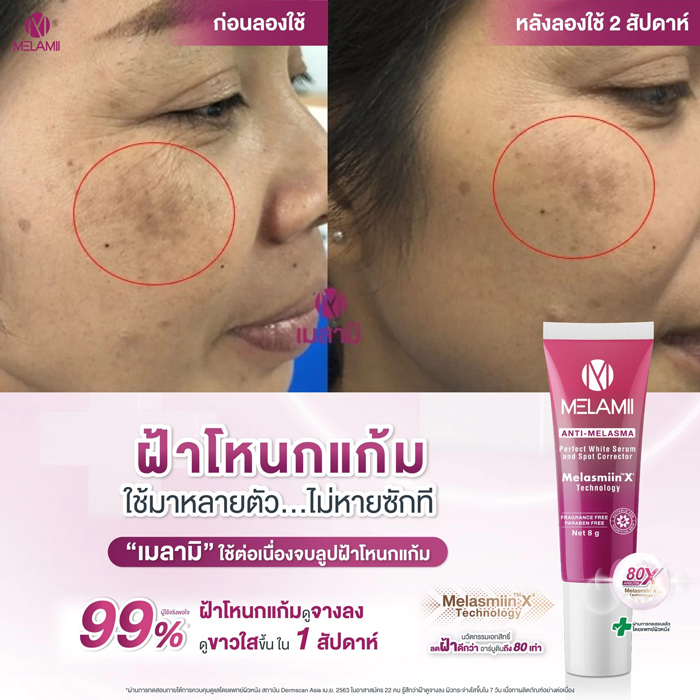 ครีมทาฝ้า Melamii Anti-Melasma Perfect White Serum & Spot Corrector