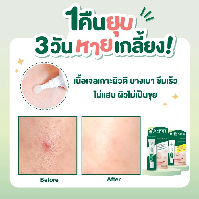 เจลแต้มสิว Mentholatum Acnes Anti-Acne Spot Gel