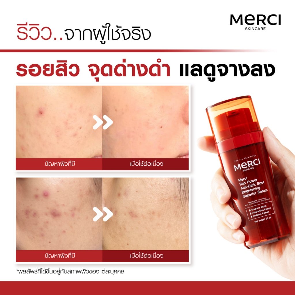 เซรั่มแก้ปัญหารอยสิว รอยดำ รอยแดง Merci Red Power Anti-Dark Spot Brightening Superior Serum