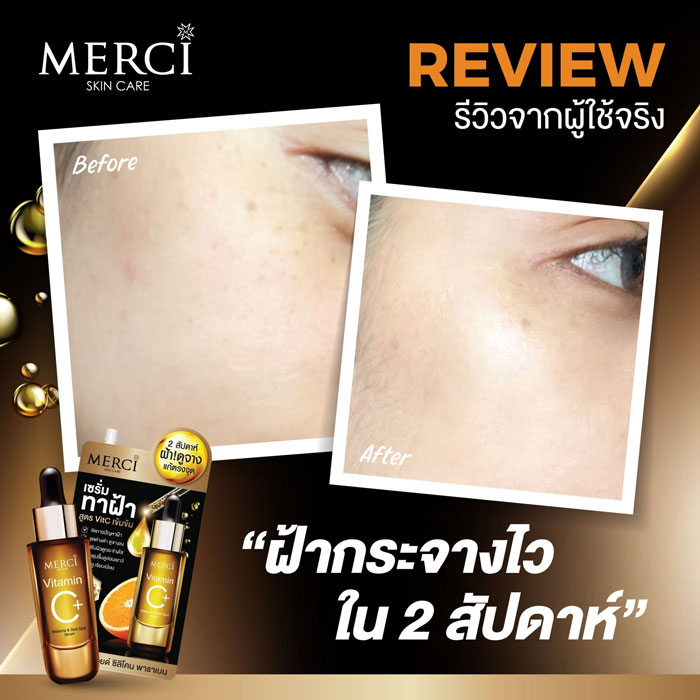 Merci Vitamin C Melasma & Dark Spot Serum ผลิตภัณฑ์บำรุงผิวหน้า