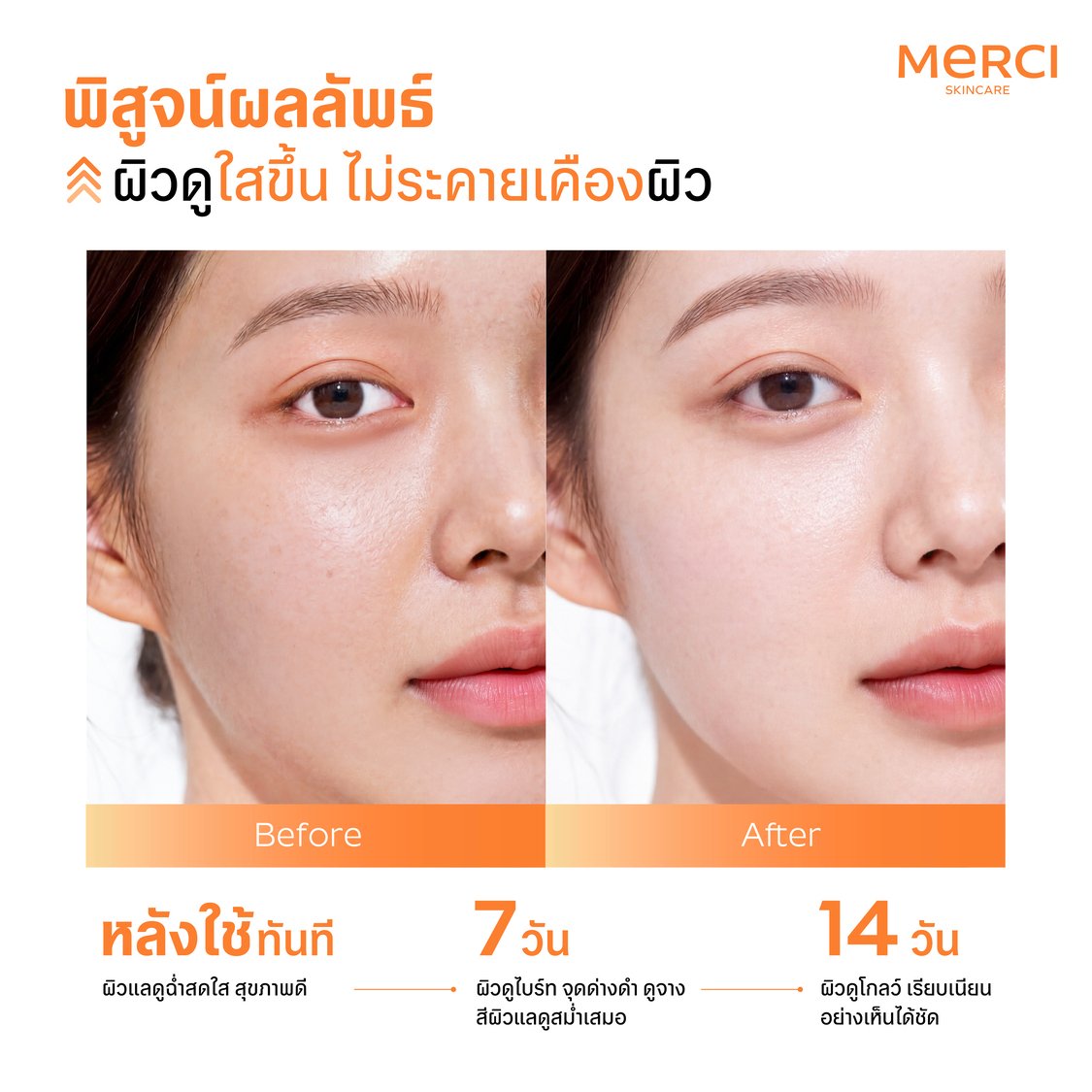 เซรั่มวิตซี Merci Vitamin C Stabilized 5c Brightening Serum