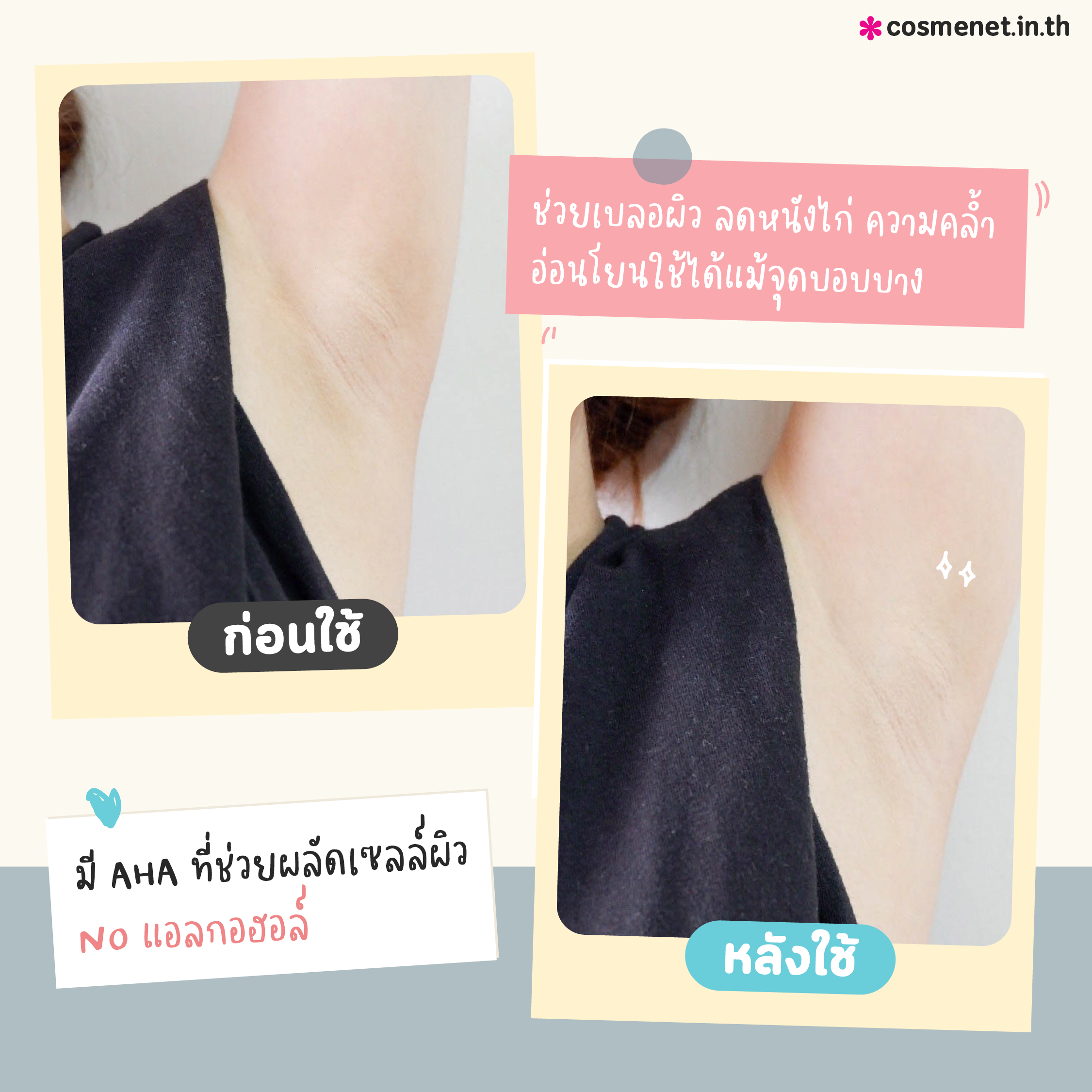 ผลิตภัณฑ์บำรุงผิวใต้วงแขน Mizumi Underarm White Booster