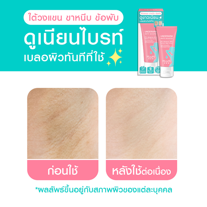 ผลิตภัณฑ์บำรุงผิวใต้วงแขน Mizumi Underarm White Booster