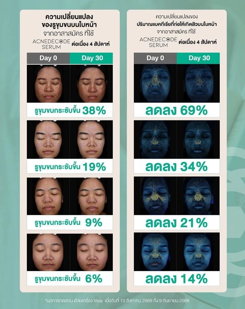 เซรั่มดูแลปัญหาสิว Moleculogy AcneDecode Serum