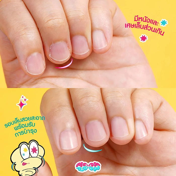 กรรไกรตัดหนังกำพร้า Moonzoon Cuticle Nippers กรรไกรตัดหนังกำพร้า Moonzoon Cuticle Nippers