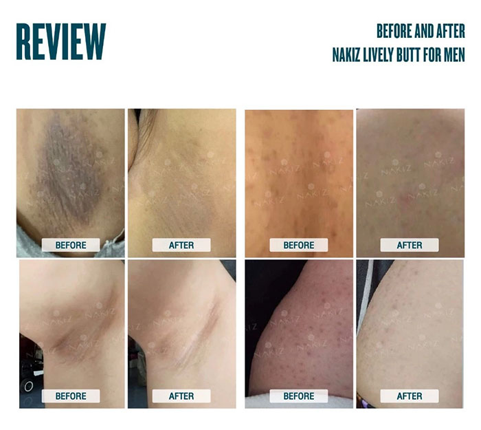 ครีมบำรุงผิวสำหรับผู้ชาย NAKIZ Livwely Butt For Men ครีมบำรุงผิวสำหรับผู้ชาย NAKIZ Livwely Butt For Men