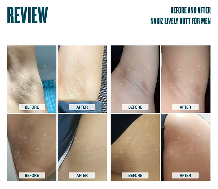 ครีมบำรุงผิวสำหรับผู้ชาย NAKIZ Livwely Butt For Men ครีมบำรุงผิวสำหรับผู้ชาย NAKIZ Livwely Butt For Men