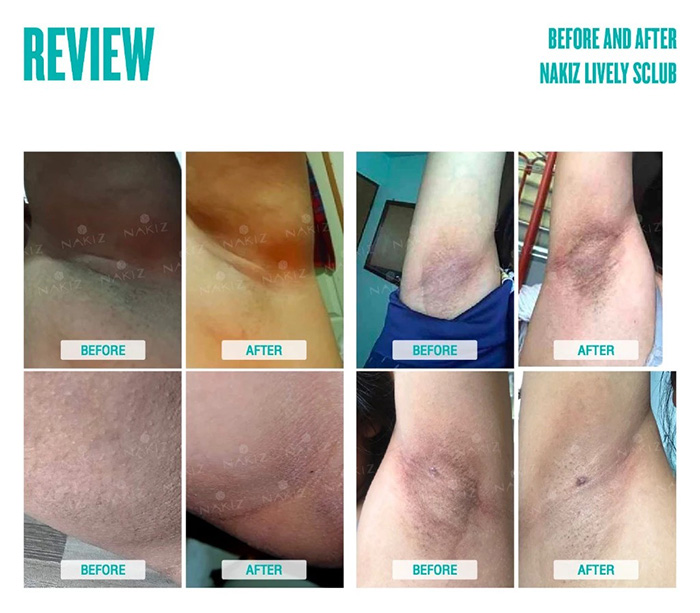 สครับขัดผิว NAKIZ Lively Scrub สครับขัดผิว NAKIZ Lively Scrub