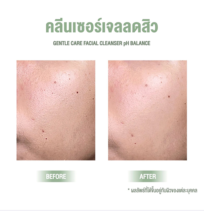 เจลล้างหน้า Nakiz Lively Nose Gentle Care Facial Cleanser