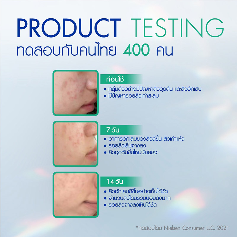 คลีนซิ่ง ลดสิว Nivea Acne Repair Advance Micellar