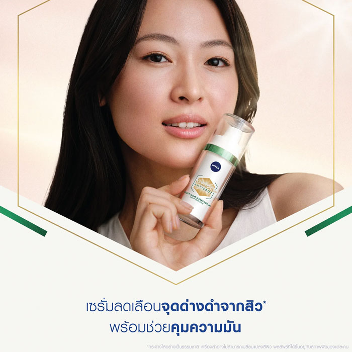 เซรั่ม Nivea Luminous 630 Antispot Post-Acne Marks Serum Skin Perfecting