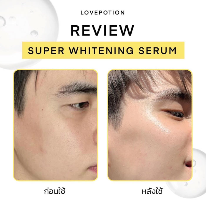 เซรั่ม Lovepotion Super White Serum