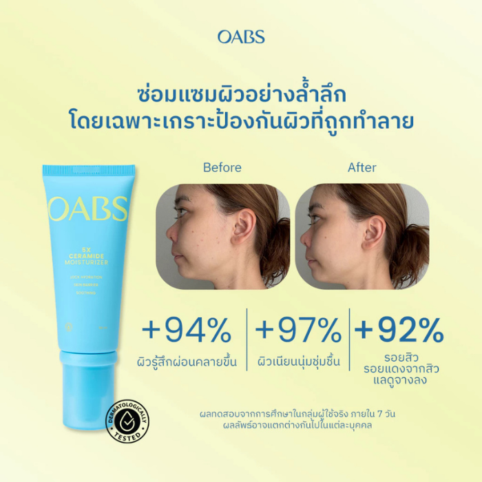 มอยส์เสริมเกราะป้องกันผิว OABS 5X Ceramide Skin Barrier Moisturizer Gel