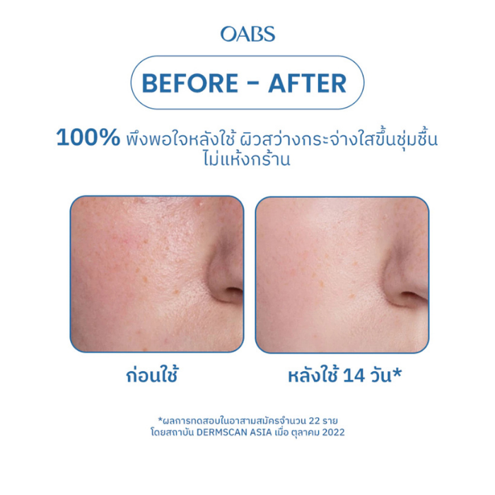 มอยส์เจอร์ไรเซอร์ OABS Melt on Illuwhite Peptide Moisturizer มอยส์เจอร์ไรเซอร์ OABS Melt on Illuwhite Peptide Moisturizer