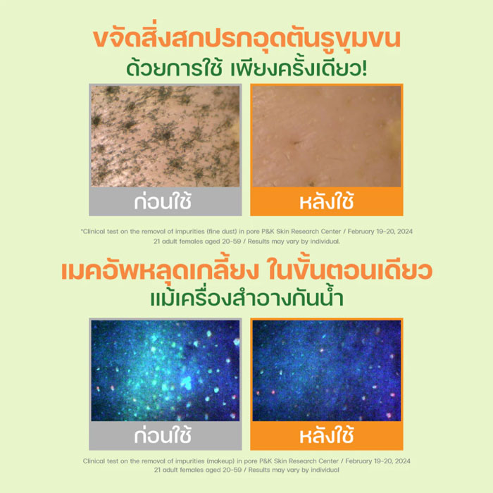 คลีนซิ่งบาล์ม Dr.G Green Deep Pore Cleansing Balm