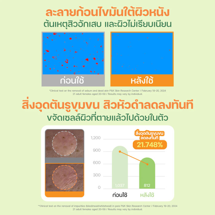 คลีนซิ่งบาล์ม Dr.G Green Deep Pore Cleansing Balm