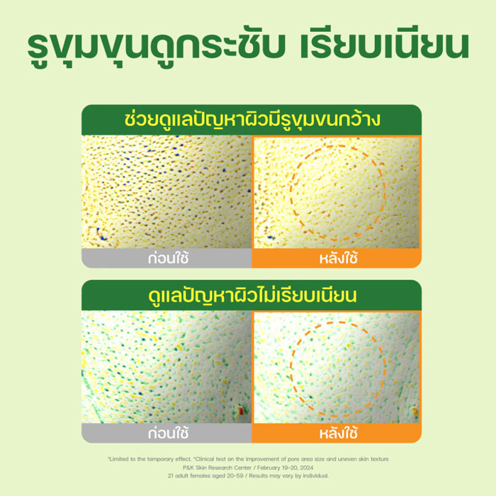 คลีนซิ่งบาล์ม Dr.G Green Deep Pore Cleansing Balm