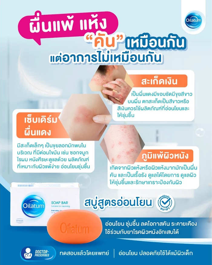 สบู่ก้อน Oilatum Soap Bar