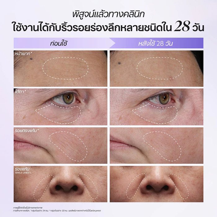 เซรั่มบำรุงรอบดวงตา Olay Retinol 24 Overnight Wrinkle Concentrate