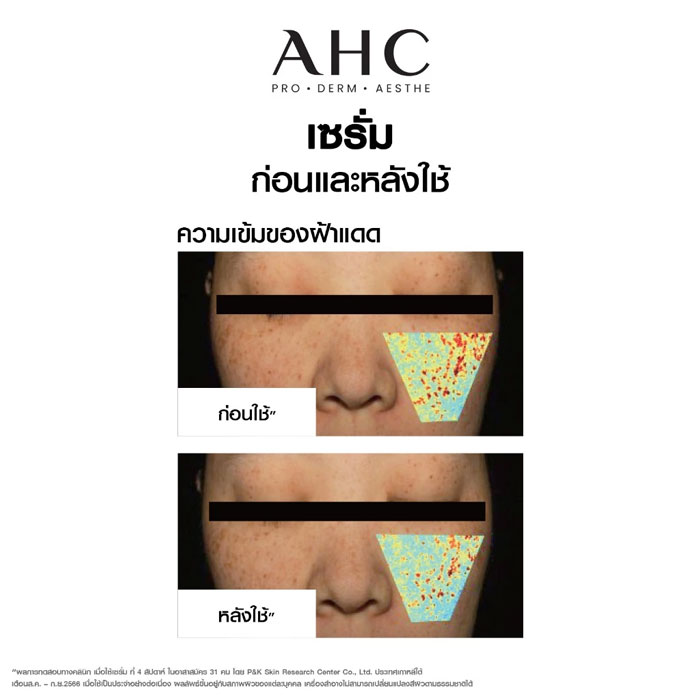 เซรั่ม AHC Gluta Ctivation Bright 3 Intra Serum