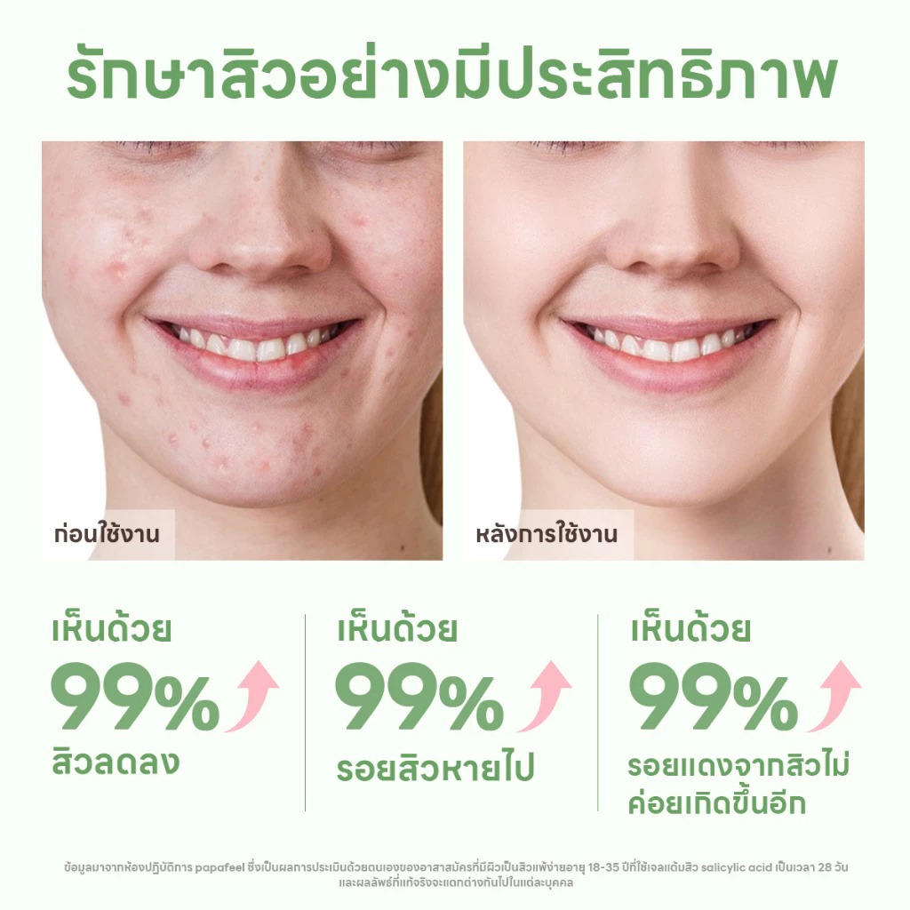 เจลแต้มสิว PAPA FEEL Salicylic acld acne removal gel