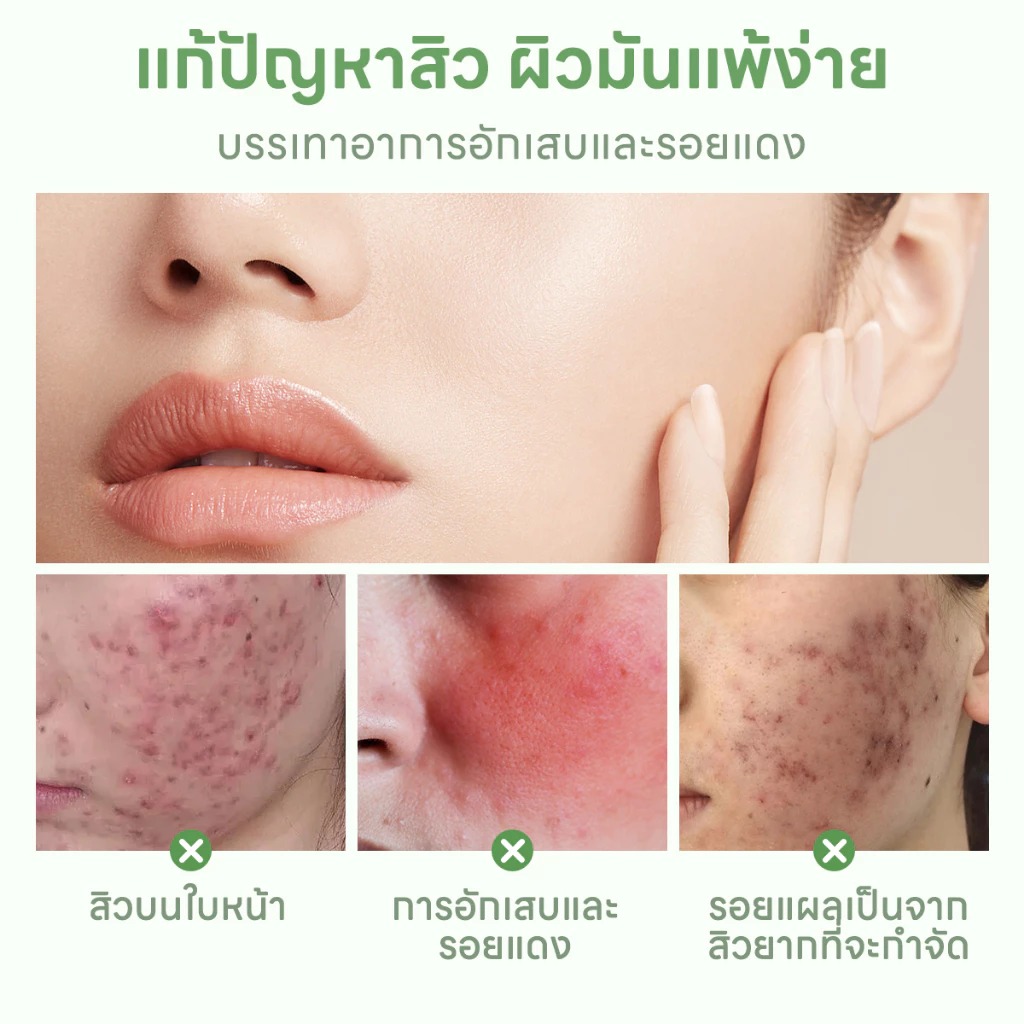 เจลแต้มสิว PAPA FEEL Salicylic acld acne removal gel