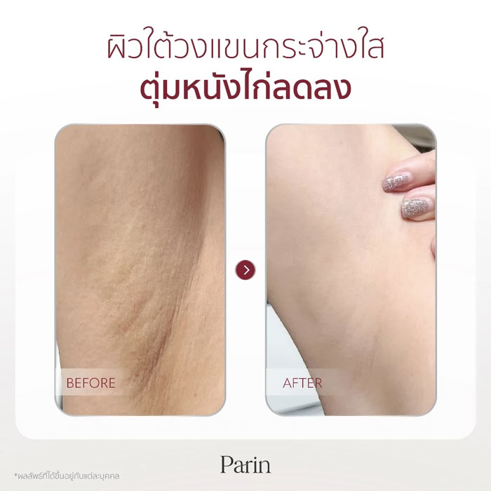 ครีมบำรุงผิวใต้วงแขน Parin Perfect White Repair Underarm Cream Plus