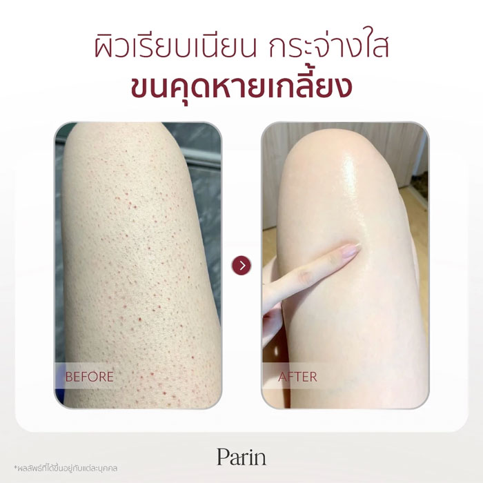 โลชั่นบำรุงผิว Parin Intensive Barrier Repair Body Lotion