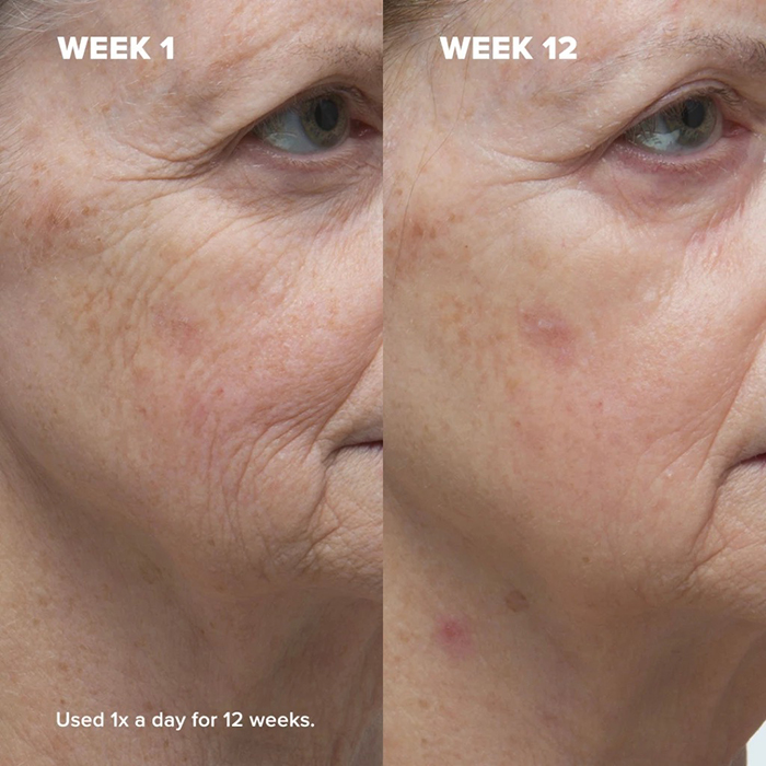 โลชั่นเรตินอล Paula's Choice Clinical 1% Retinol Treatment