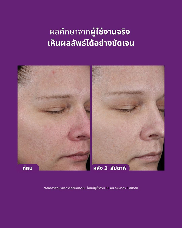 ทรีตเม้นท์ Paula's Choice PRO Retinaldehyde Treatment