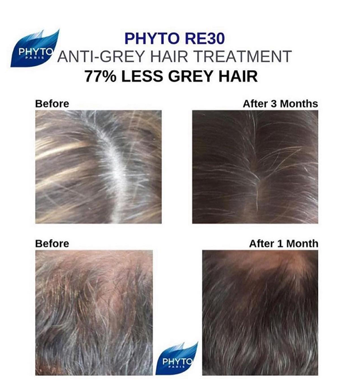 Phyto Re30 Avant Apres
