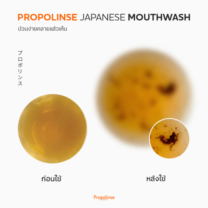 น้ำยาบัวนปาก Propolinse Yuzu Mouthwash น้ำยาบัวนปาก Propolinse Yuzu Mouthwash