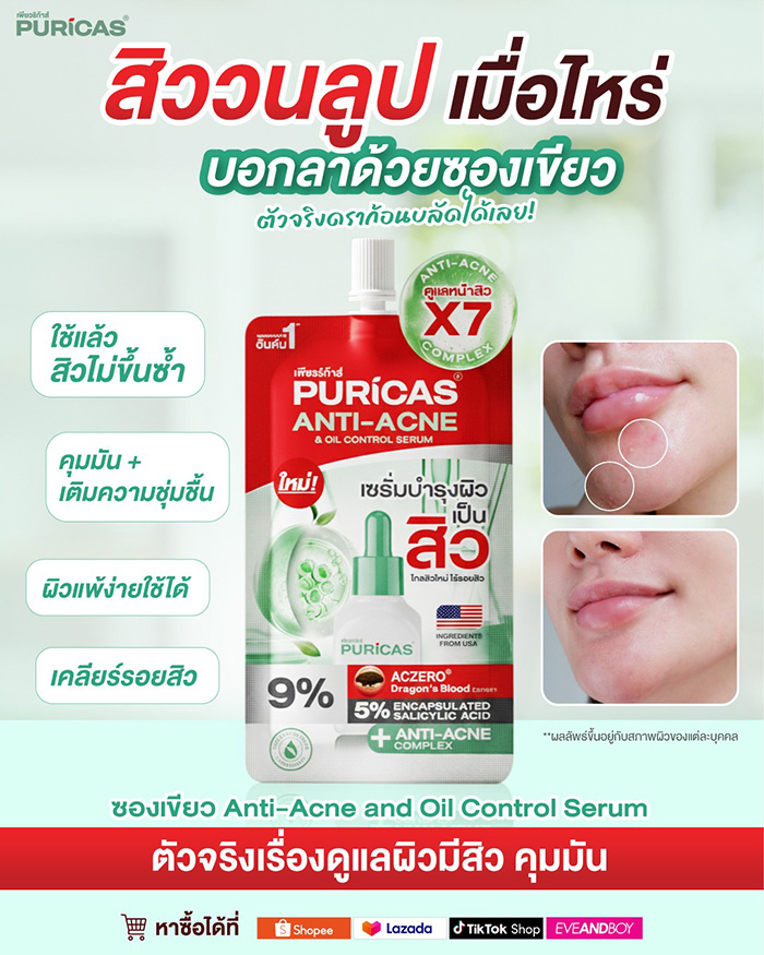 เซรั่ม Puricas Anti Acne And Oil Control Serum