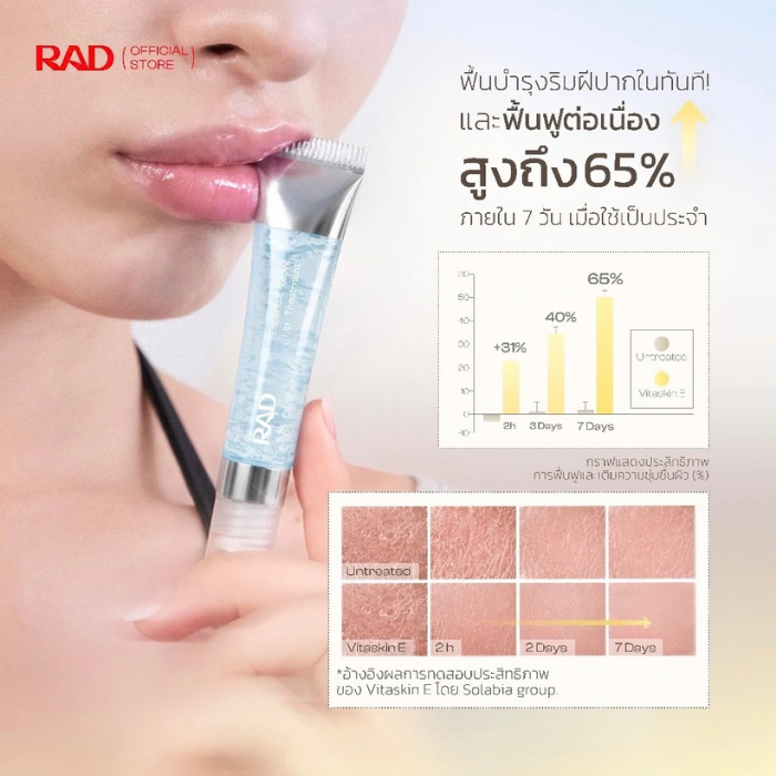 ลิปทรีทเมนต์ RAD Cosmetics Essential Glow Lip Treatment ลิปทรีทเมนต์ RAD Cosmetics Essential Glow Lip Treatment