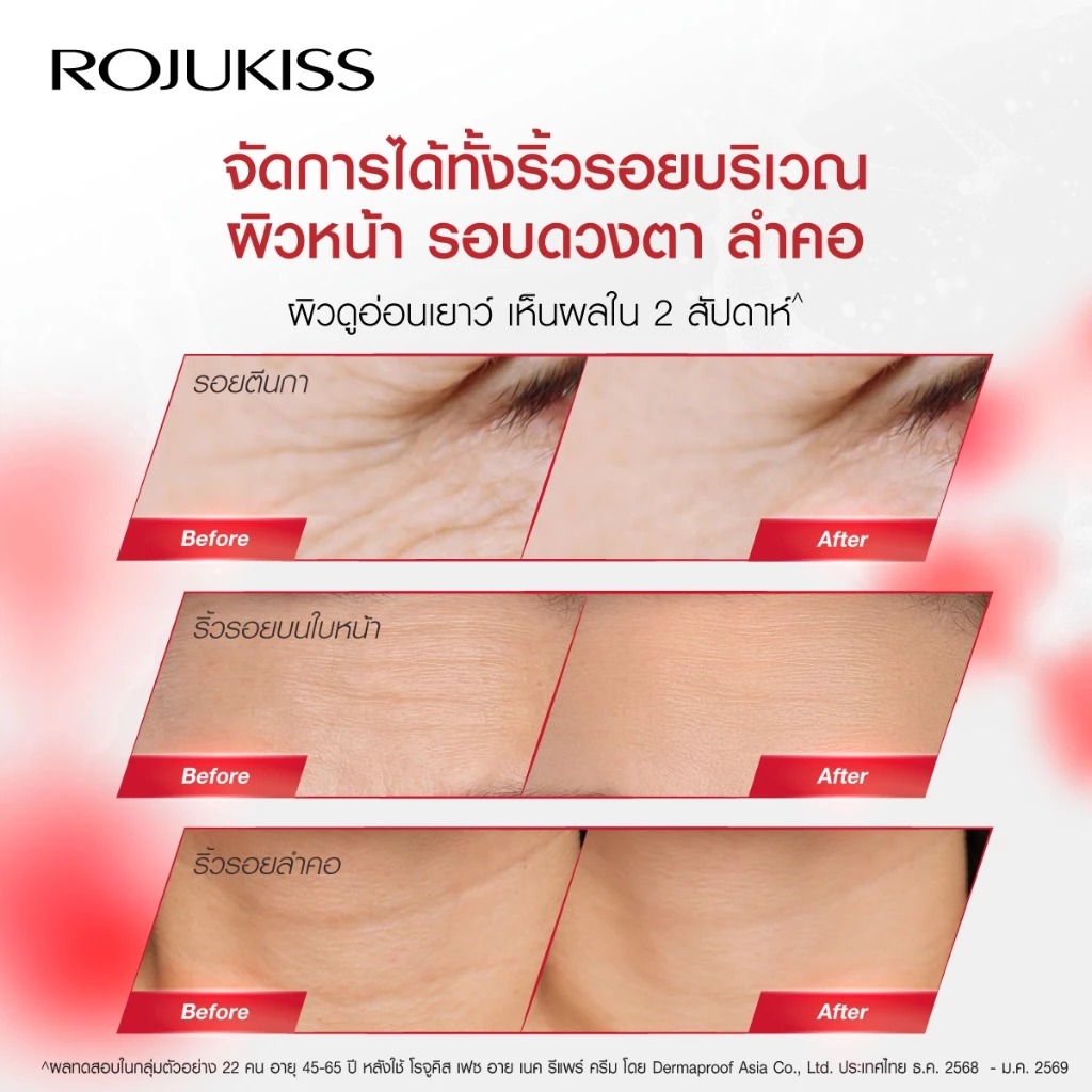 เซรั่ม Rojukiss Face Eye Neck Repair Serum