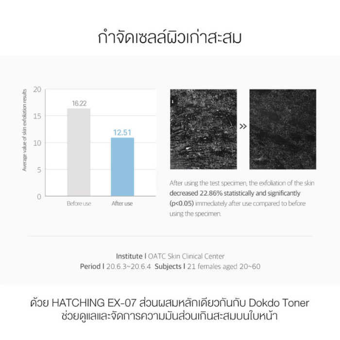 เอสเซนส์มาส์ก Round Lab 1025 Dokdo Hydrating Water Gel Mask เอสเซนส์มาส์ก Round Lab 1025 Dokdo Hydrating Water Gel Mask