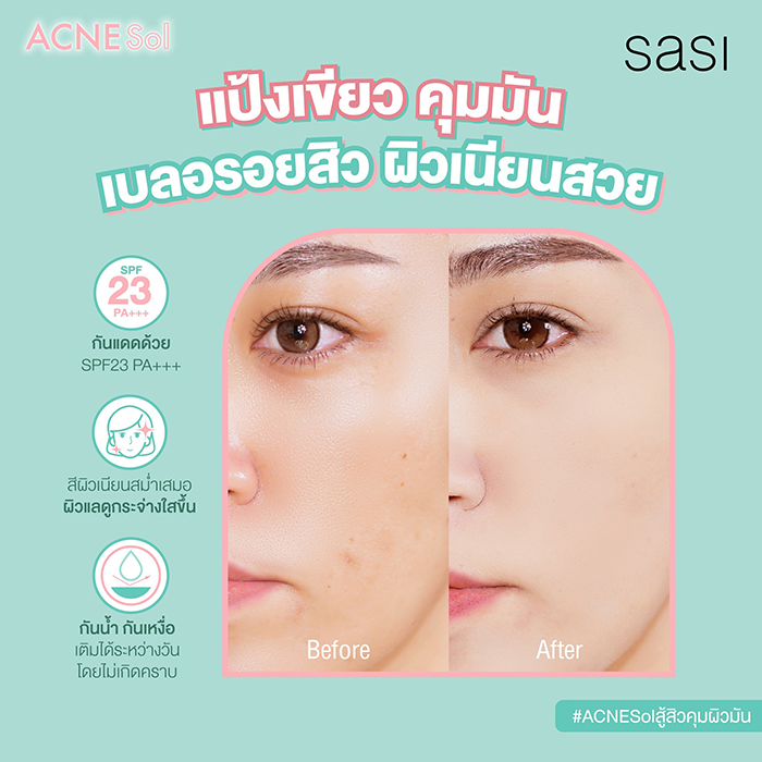 แป้งอัดแข็ง SASI Acne Sol Comfort Powder 