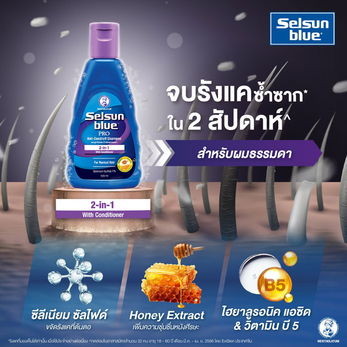 แชมพูขจัดรังแค สำหรับผมธรรมดา Selsun Blue 2-in-1 Pro Anti-Dandruff Shampoo