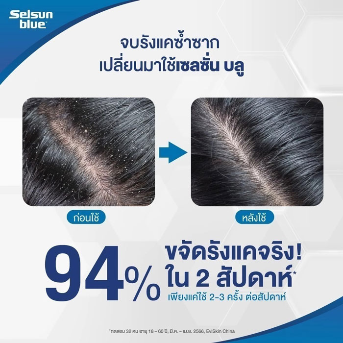 แชมพูขจัดรังแค สำหรับลดคันหนังศีรษะ Selsun Blue Extra Strength Pro X Anti-Dandruff Shampoo