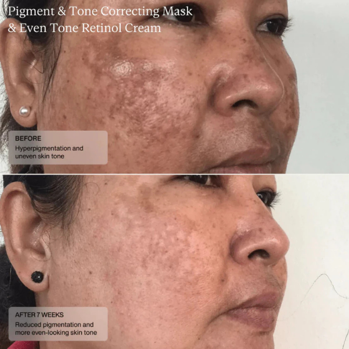 ครีมทาฝ้า Senté Cysteamine HSA