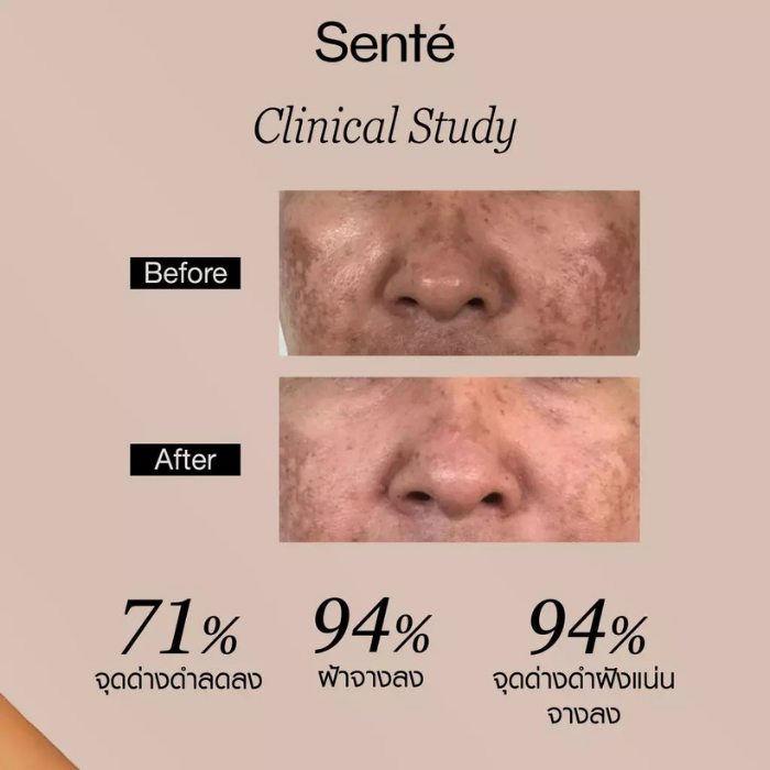 ครีมทาฝ้า Senté Cysteamine HSA