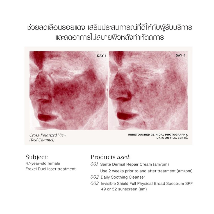 ครีมบำรุงผิว Senté Dermal Repair Cream ครีมบำรุงผิว Senté Dermal Repair Cream