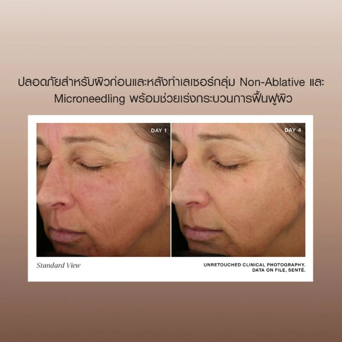 ครีมบำรุงผิว Senté Dermal Repair Cream ครีมบำรุงผิว Senté Dermal Repair Cream