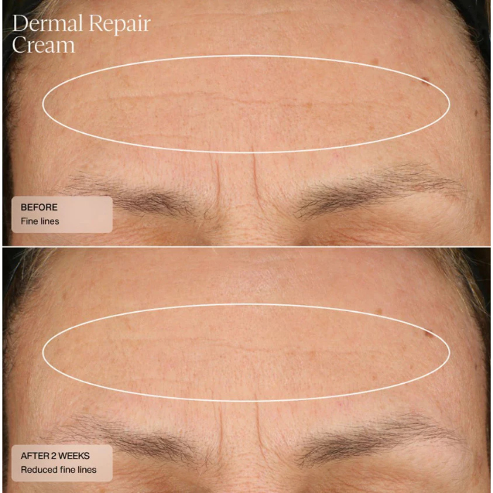ครีมบำรุงผิว Senté Dermal Repair Cream ครีมบำรุงผิว Senté Dermal Repair Cream