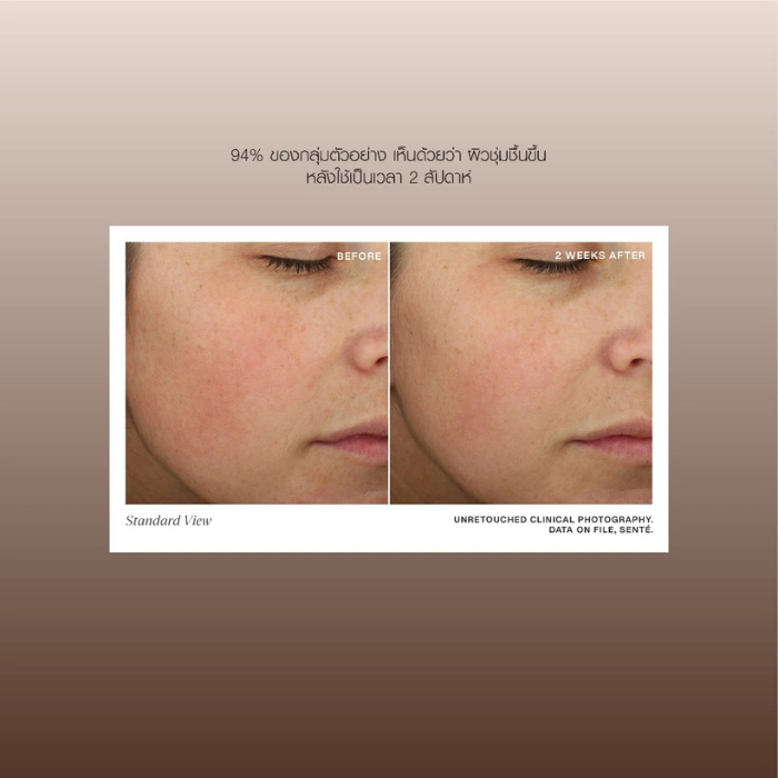 เรตินอล Senté Even Tone Retinol Cream เรตินอล Senté Even Tone Retinol Cream